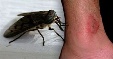 These Are The Best Ways To Treat A Horsefly Bite Nottinghamshire Live