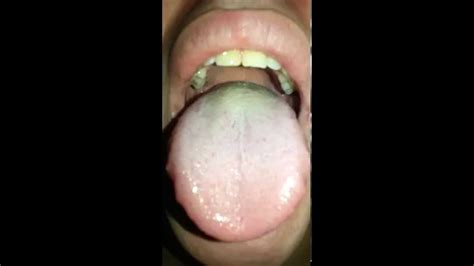 My Mouth Tongue And Uvula Youtube