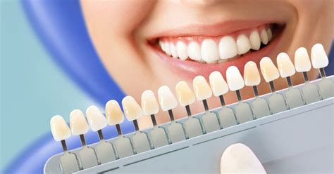 teeth whitening 101 guide to brighter teeth ntuc health denticare ntuc health denticare