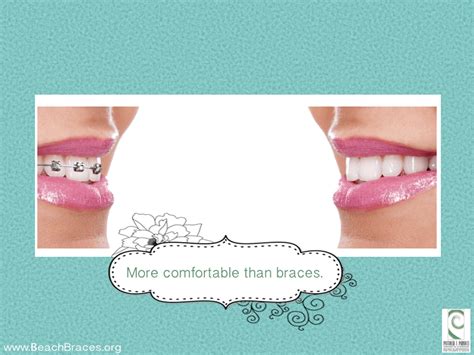Benefits Of Invisalign 7 Beach Braces Orthodontic Specialists Invisalign Lingual Braces