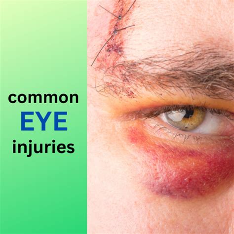 Common Eye Injuries Board Certified Eye Doctors Burlington Bucks