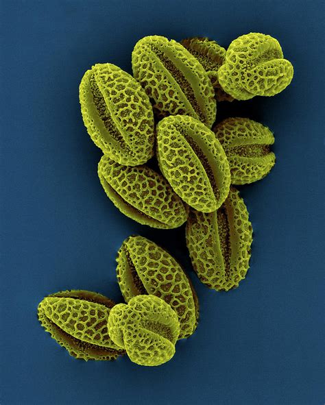 Weeping Willow Pollen Salix Babylonica Photograph By Dennis Kunkel