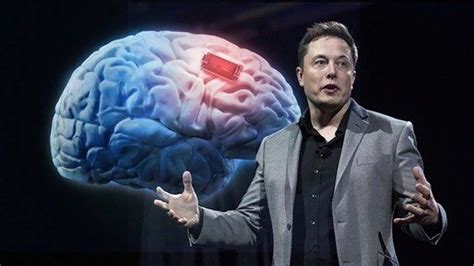 Neuralink Elon Musk Presentó Su Plan Para Implantar Chips En El