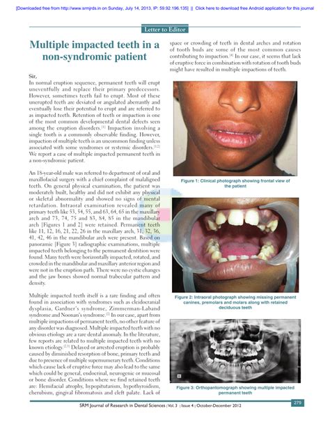 Pdf Multiple Impacted Teeth In A Non Syndromic Patient
