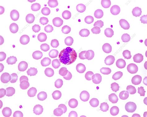 Human Blood Smear With Eosinophil Light Micrograph Stock Image