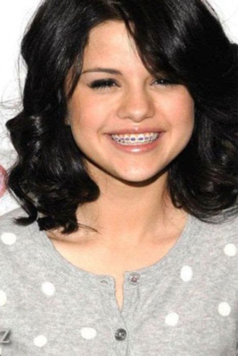15 celebs with braces and invisalign ideas celebrities with braces braces celebrity smiles
