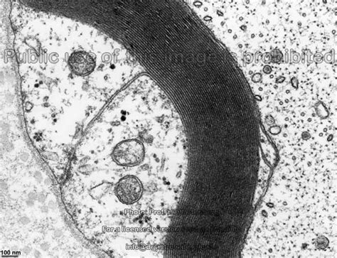 Schwann Cells Drjastrows Electron Microscopic Atlas