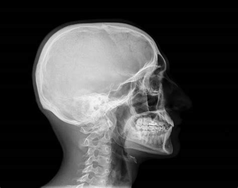 Best Human Skull Profile Stock Photos Pictures And Royalty Free Images