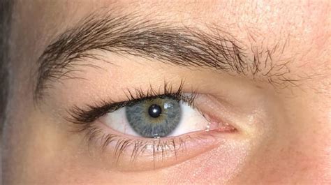 I Have Blue Eyes But Why Do I Have Hazel Center And No Limbal Ring