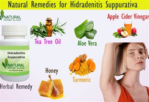 Make Use Of Given 10 Natural Remedies For Hidradenitis Suppurativa