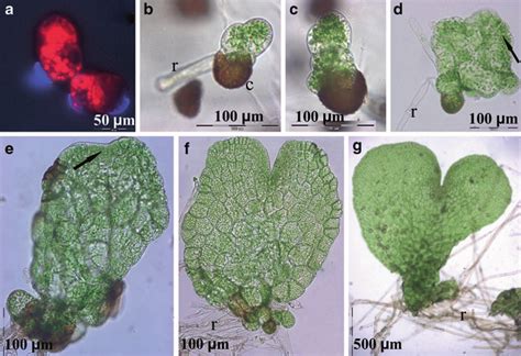 1 Cyathea Australis Spore Germination And Prothallium Formation On ½ms