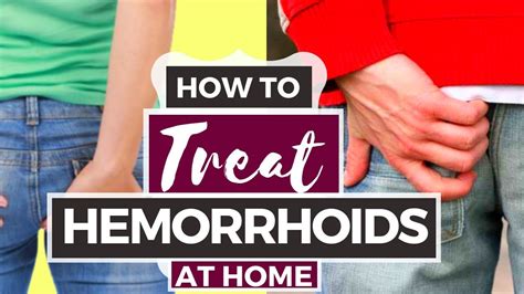 hemorrhoids treatment at home databasetiklo