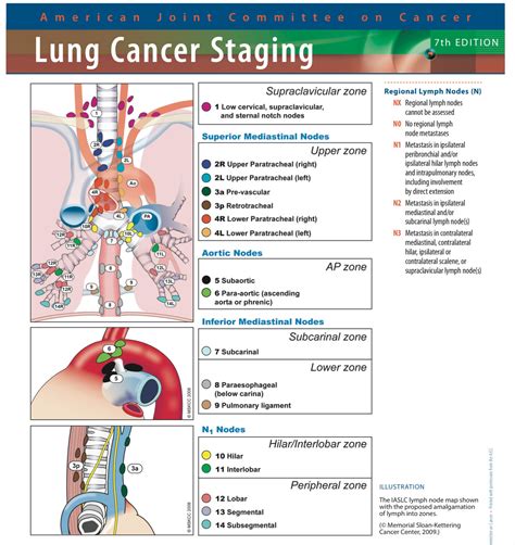 Ajcc 8th Edition Lung Cancer Ajcc 7th Edition Staging System For