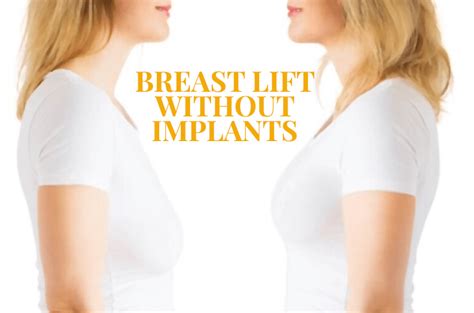 Breast Lift Without Implants Tips For A Successful Breast Lift