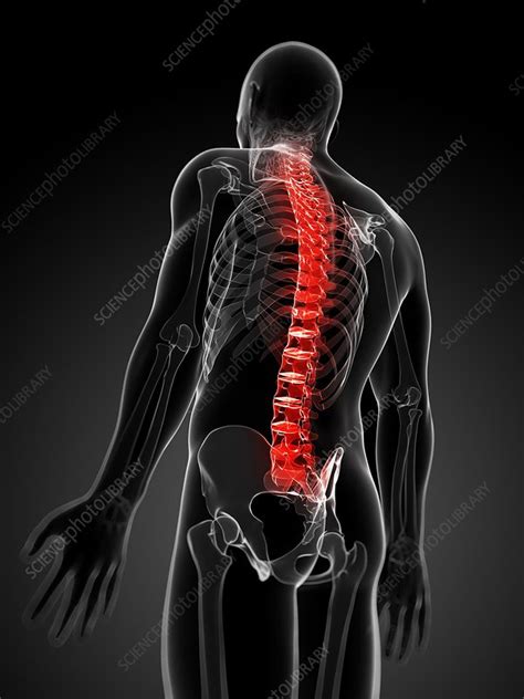 Back Pain Conceptual Artwork Stock Image F0062953 Science Photo