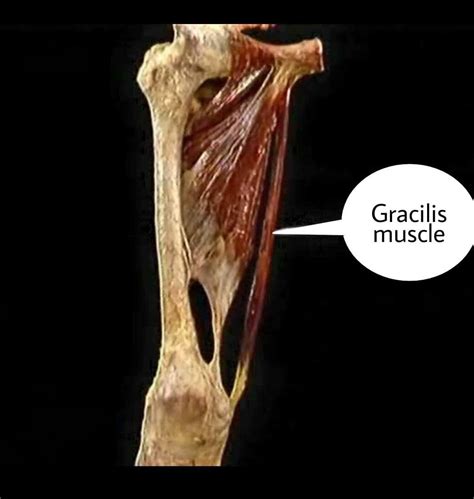 عضله گراسیلیس اطلس الکترونیک آناتومی