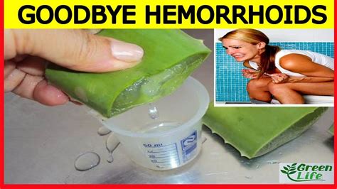 Best Hemorrhoids Treatment How To Get Rid Of Hemorrhoids Fast