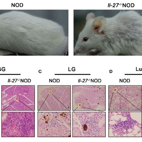 Interleukin 27 Gene Deficiency Aggravated Ss In Nod Mice A The