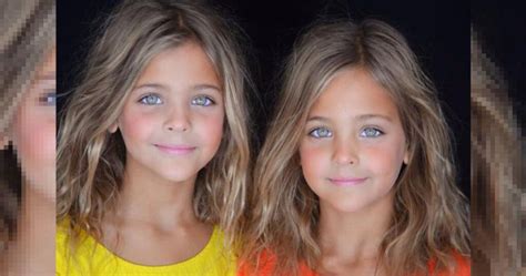 Sono le gemelle più belle del mondo a soli 8 anni hanno già 1 mln di