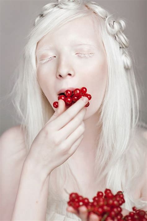 Nastya Zhidkova Albino Model Beauty Albinism