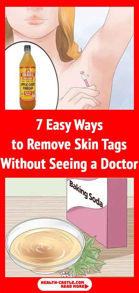 7 easy ways to remove skin tags without seeing a doctor skin tag removal skin tag skin care