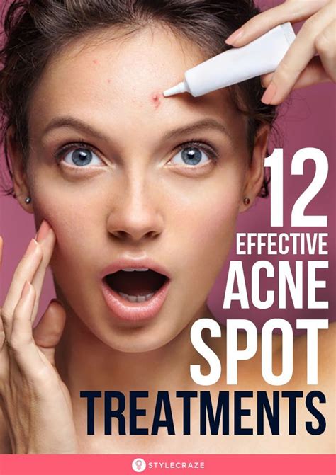 15 Best Acne Spot Treatments If Your Acne Troubles Are Nowhere Nearing