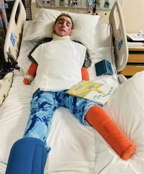 Wish Coming For Boy Who Lost His Arms And Leg In A Tragic Accident
