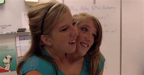 They have one body, share a pair of limbs, with two heads, two pairs of eyes, two necks, with separate vital organs such as two hearts, three kidneys, two spines joined at the pelvic region and four lungs but share. After overcoming the odds, Abigail and Brittany Hensel have their dream careers