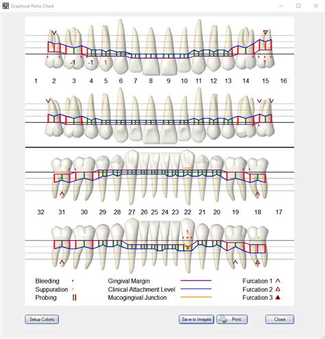Open Dental Software Graphical Perio Chart