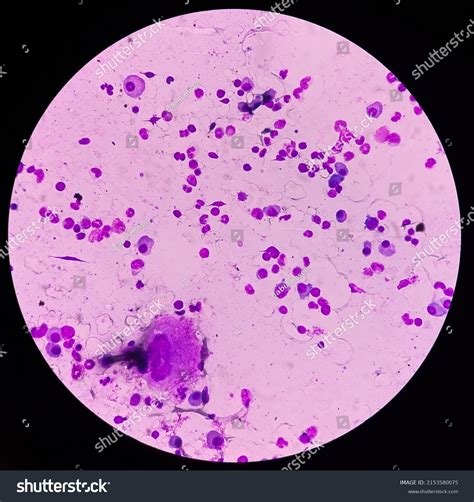 Bone Marrow Study Megakaryocyte Large Bone Stock Photo 2153580075