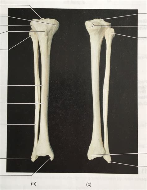 Tibia And Fibula Anterior And Posterior Views Real Diagram Quizlet