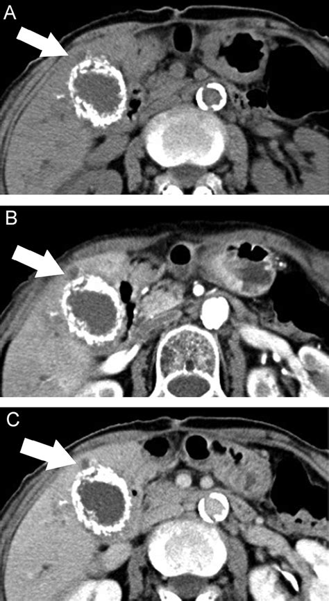 Dynamic Contrast Enhanced Computed Tomography Ct At The Level Of The