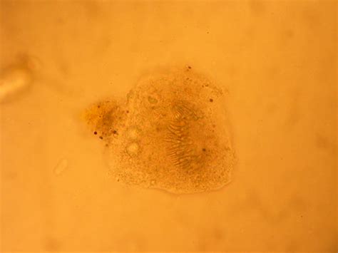 Echinococcus Sp Hydatid Fluid From Hydatid Cyst Showing Flickr