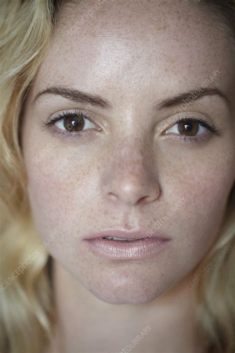 Close up of woman's freckled face - Stock Image - F004/2255 - Science ...
