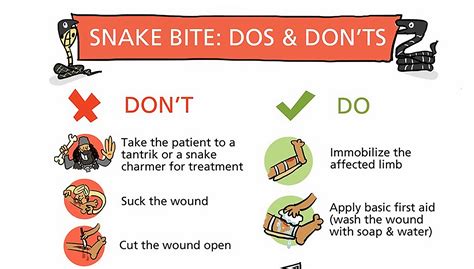 How To Provide First Aid For Snake Bites Snake Poin