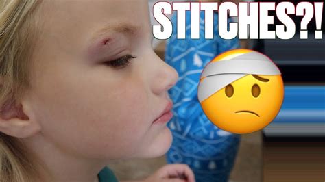 Four Year Old Splits Head Open On Banister At Christmas Party