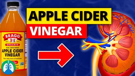 Can Apple Cider Vinegar Hurt Your Kidneys All Answers