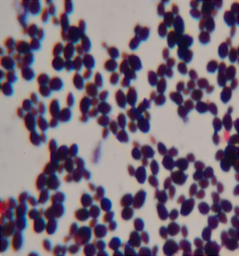 Figure 2 Microscopic Characteristics Of Candida Spp Prevalence Of