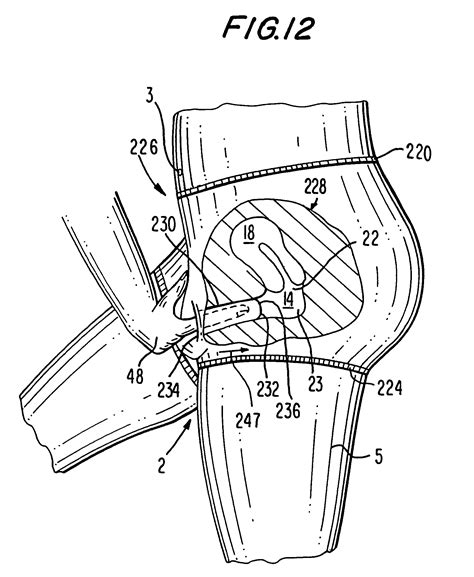 Patent Us7823591 Female Barrier Contraceptive With Vacuum Anchoring
