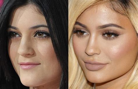 Top 25 Celebrities Before And After Plastic Surgery And Nose Jobs