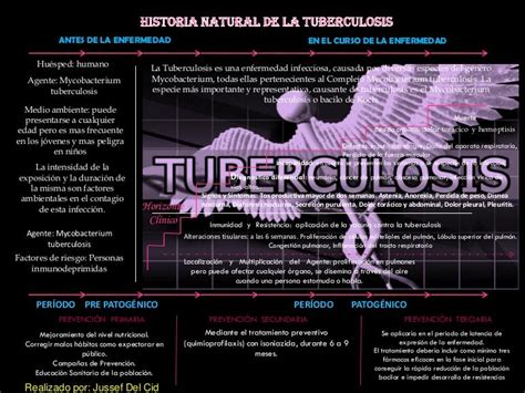 Historia Natural De La Tuberculosis