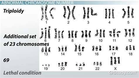 Abnormal Chromosome Number Structure Lesson Study Com