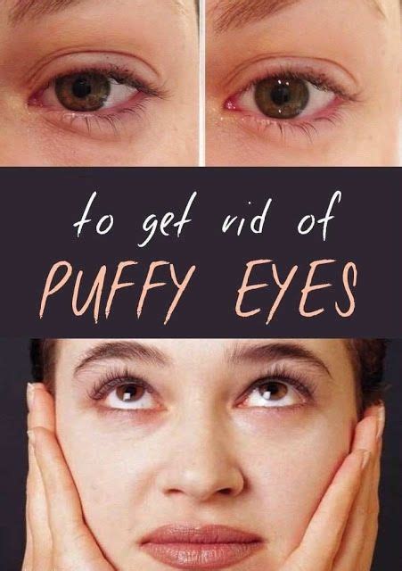 How To Get Rid Of Puffy Eyes Cure Puffy Eyes Puffy Eyes Get Rid Of