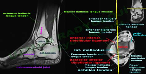 Foot Muscles Mri Ankle And Foot Radiology Key There Are 10