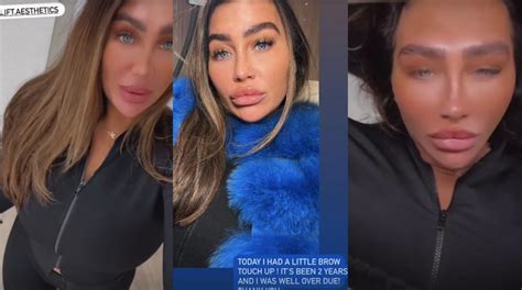 Lauren Goodger Joins Katie Price And Reveals New Butterfly Lips After