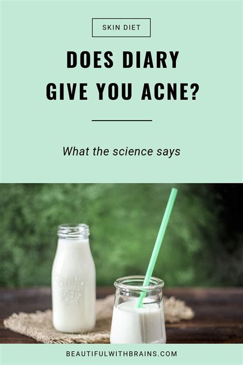 Does Dairy Cause Acne Heres What The Science Says