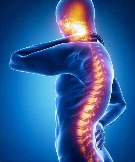 When Do You Need A Back Injury Lawyer