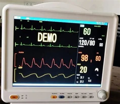 List 90 Images What Does A 7 Day Heart Monitor Look Like Stunning 122023