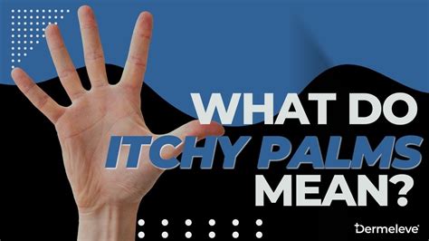 What Do Itchy Palms Mean Dermeleve® Youtube