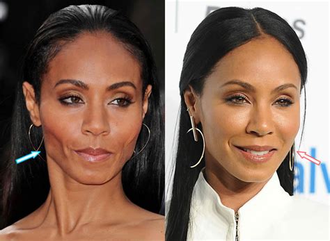Jada Pinkett Smith Plastic Surgery Before And After Cheek Plumped And Botox Plastic Surgery